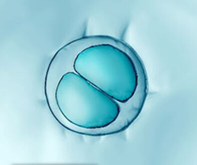 Frozen Embryos: The Law at a Crossroads
